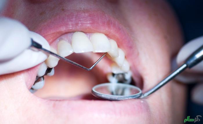 نکات بهداشتی دهان و دندان